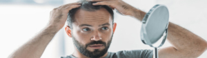 Hair Scene Blog - Male Hair Loss