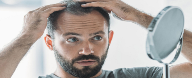 Hair Scene Blog - Male Hair Loss
